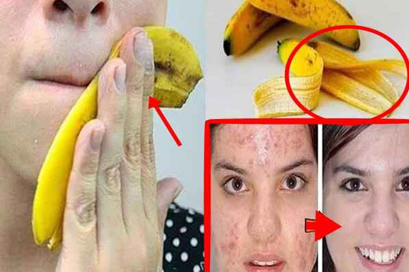 Thedalweb 20 banana mask for skin whitening