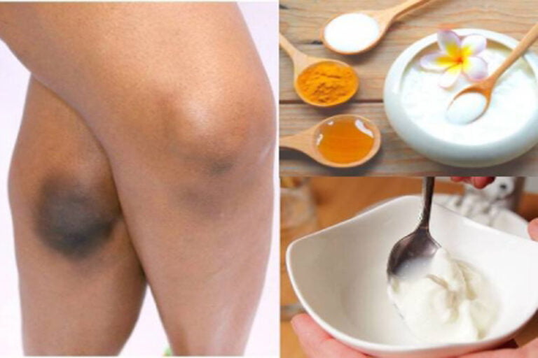 knee ugly 1 Thedalweb உங்க முழங்கால் அசிங்கமா கருப்பா இருக்கா? | how to get rid of dark knees quickly at home